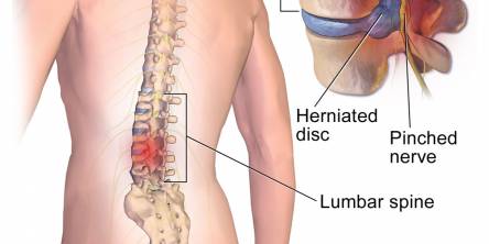 lower back pain relief products