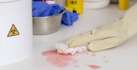 Death clean up
