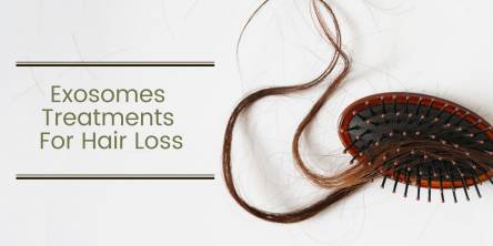 Exosomes Treatments For Hair Loss