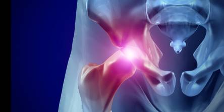 Sciatic nerve treatment