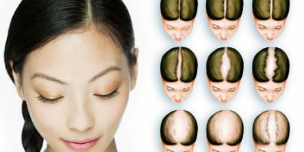 Best Hair Fall Solution